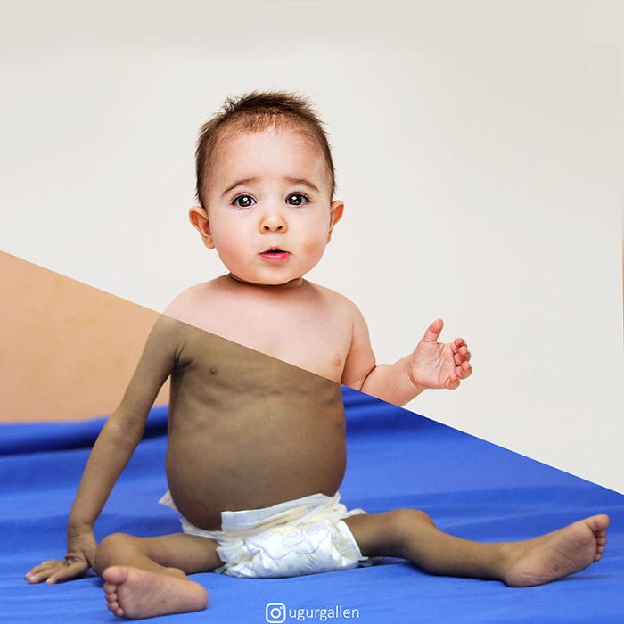 Ugur Gallen, las otras realidades que ignoramos 4 Yemen 1